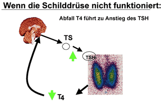 Schilldrüse Funktionsstörung